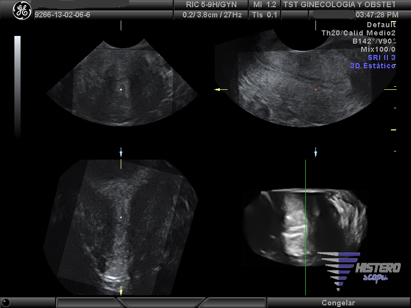 utero t 3d 2