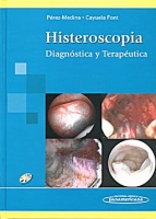 Histeroscopia diagnóstica y terapéutica