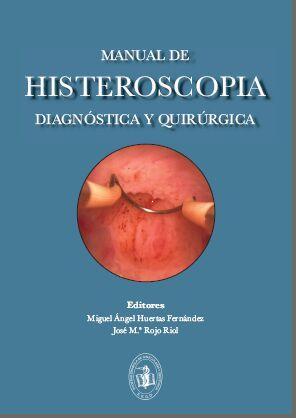 histeroscopia